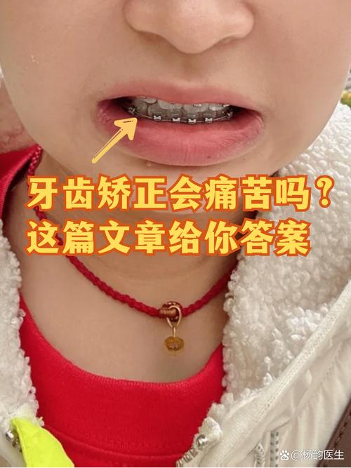 牙齿矫正还能当兵吗_牙齿矫正还能吹号吗_38岁了还能不能牙齿矫正