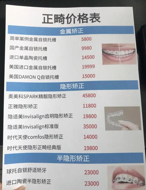 杭州矫正牙齿费用全解析：别再被坑了！2026最新价格表