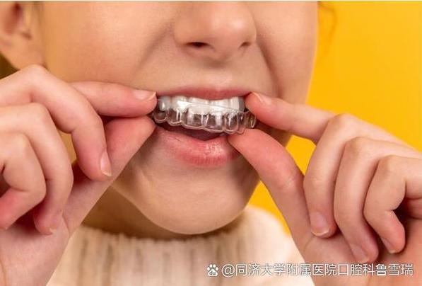 杭州6岁孩子地包天矫正到底晚不晚