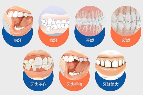 杭州合肥隐形牙齿矫正费用贵不贵？要多少钱？