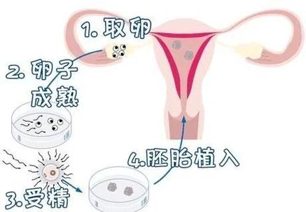 杭州无精症试管流程及费用到底怎么算？一篇讲明白