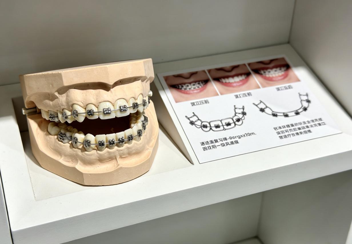 杭州东莞看牙到底选哪家好？医生技术、资质和消毒怎么挑才靠谱