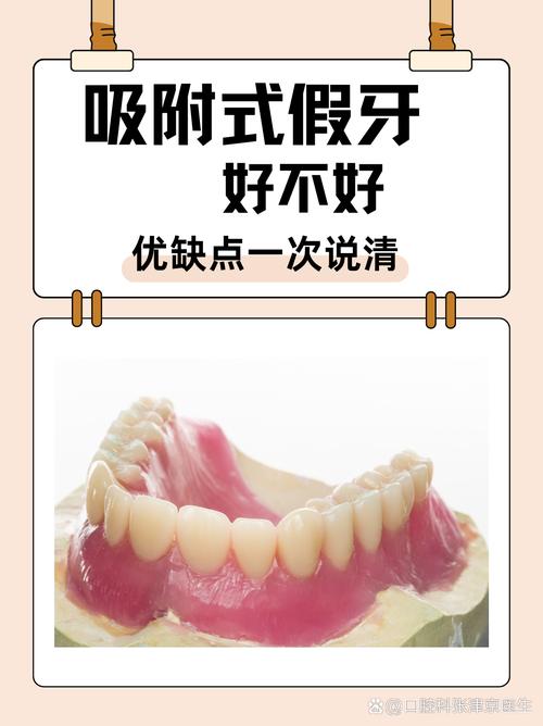 杭州缺牙不种牙？活动假牙固定桥吸附性义齿哪个好