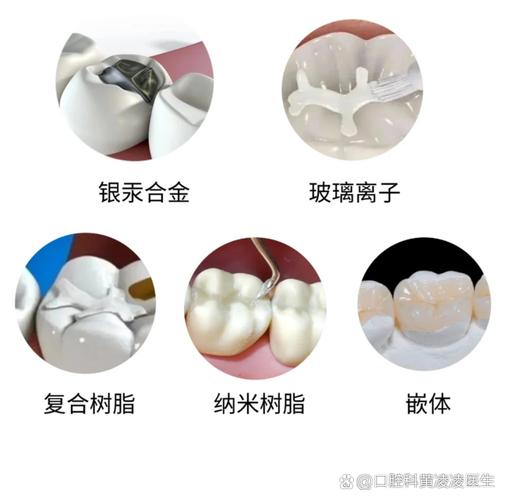 杭州补牙用什么材料好？哪种补牙材料最靠谱？