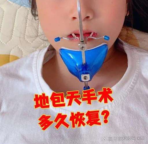 杭州正颌手术矫正牙齿靠谱吗，效果能维持多久