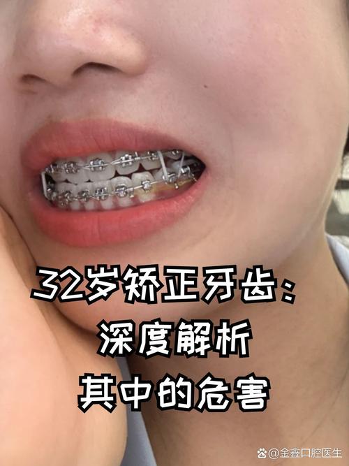 39岁做牙齿矫正晚不晚_牙齿矫正的最晚_矫正牙齿晚上戴的是什么仪器