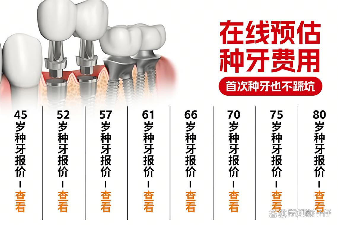 杭州深圳罗湖种牙哪家靠谱 诺贝尔种植牙医院怎么选
