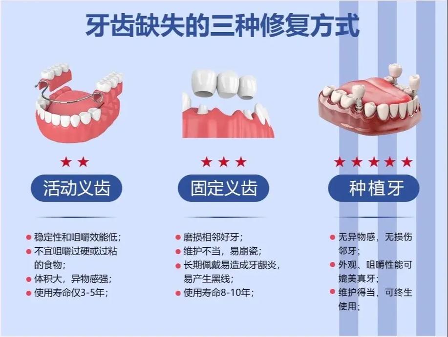 杭州缺牙不种牙还有哪些靠谱的修复方法