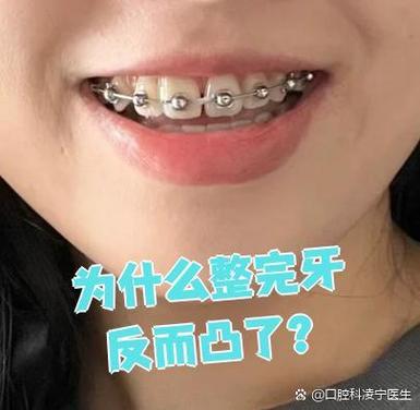 杭州牙齿不齐别担心 纠正牙齿的较佳年龄看这里
