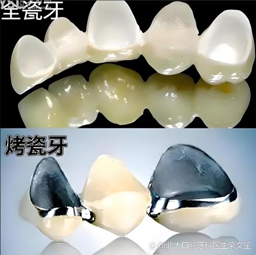 杭州天津种一颗牙要多少钱？看完这篇就懂了