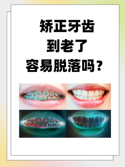 杭州43岁矫正牙齿晚不晚 过来人告诉你答案