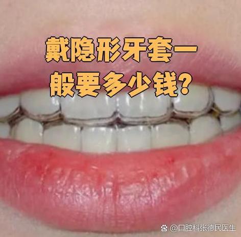 常州隐形牙齿矫正钱需要多少钱_牙齿矫正价格隐形_常州隐形矫正牙齿需要多少钱