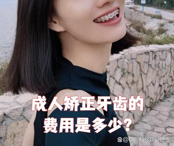 杭州隐形矫正牙齿前必看 效果费用全解析