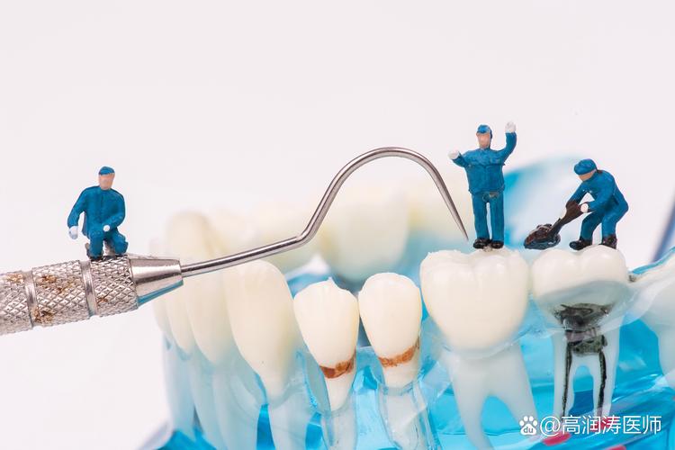 种牙价格对比指南_iti种牙的价格_种牙价格表2022年