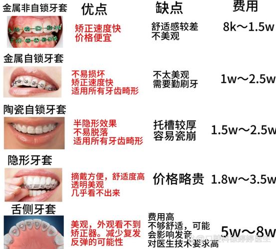 杭州深圳福田青少年做钢丝牙套大概要花多少钱？