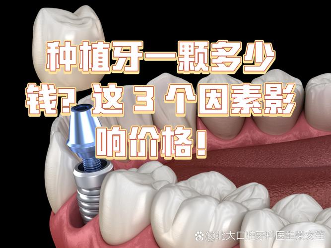 杭州镶一颗种牙要多少钱 影响种植牙费用的关键因素梳理