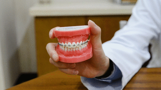 杭州深圳蛇口隐形矫正到底多少钱？2026年真实费用大揭秘