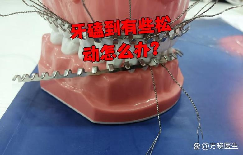杭州孩子牙齿磕碰松动了怎么办？多久能自己长好