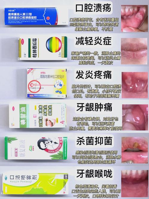 杭州小孩口腔溃疡吃什么好的快？收下这份家庭偏方与饮食指南，轻松缓解娃的疼痛