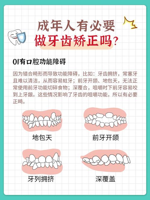 牙齿矫正大概需要多少钱_45岁矫正牙齿_牙齿矫正最佳年龄段