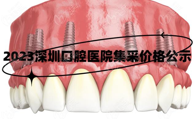 杭州深圳种牙集采落地，到底能省多少钱？