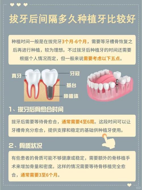 杭州拔牙后必须马上种牙吗？等多久最合适
