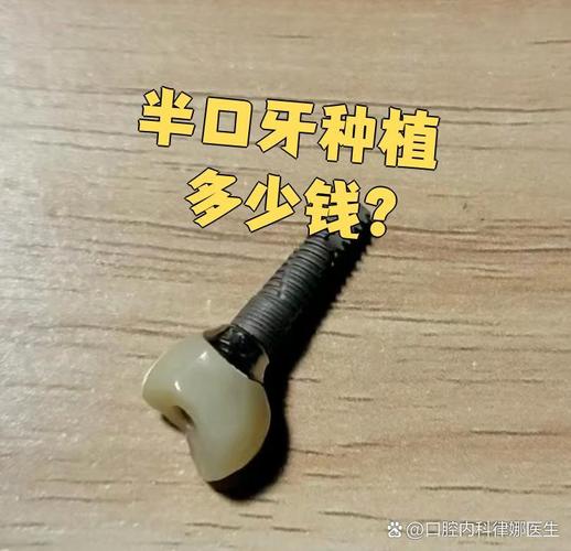杭州深圳宝安半口种牙多少钱 中老年价格详解