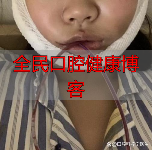 杭州口腔颌面部受伤啥特点？不只影响呼吸进食，感染风险也很高