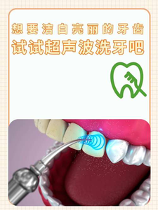 杭州自己用超声波洗牙安全吗？洗牙是医疗行为，别自己瞎搞