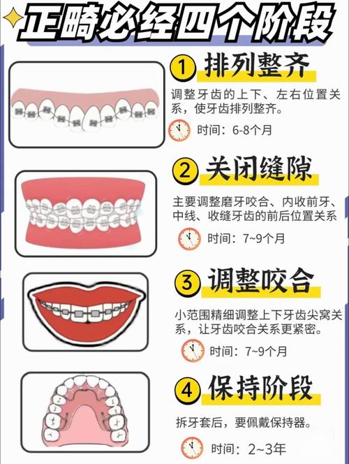 杭州成人牙齿矫正全攻略：30-40岁做还来得及吗？需要几年时间？