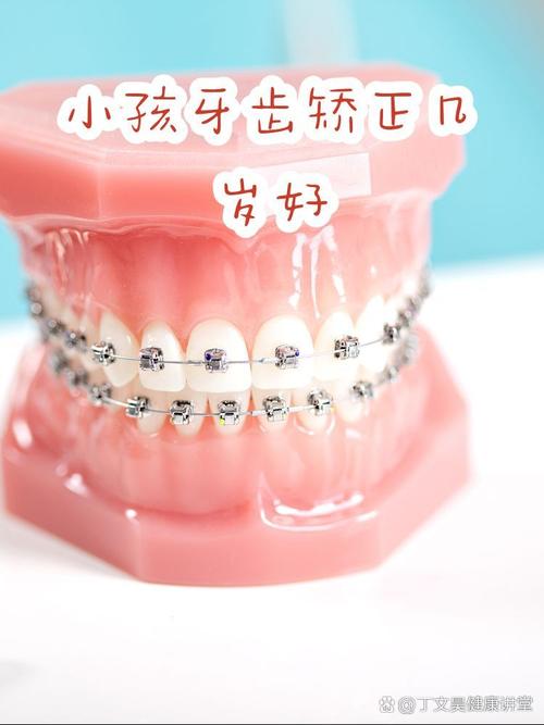 杭州16岁牙齿矫正晚吗？医生：抓住黄金期，效果一样好
