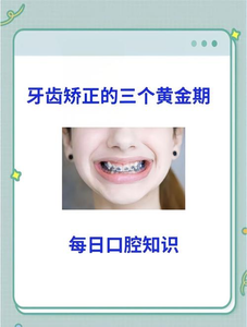 杭州16岁矫正牙齿真的晚吗？抓住黄金期的尾巴，效果一样好