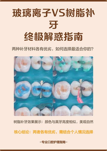杭州补牙材料有哪几种？牙医详解复合树脂和玻璃离子的优缺点