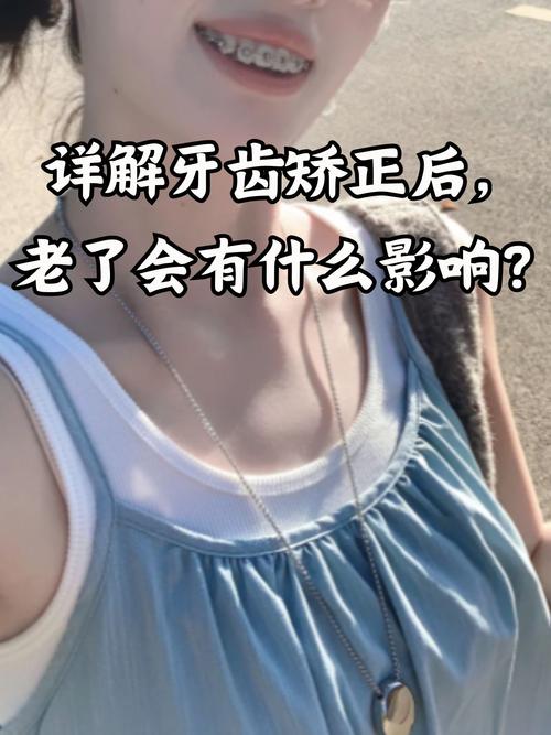 杭州40岁了做牙齿矫正好吗？效果和疼痛一次说清