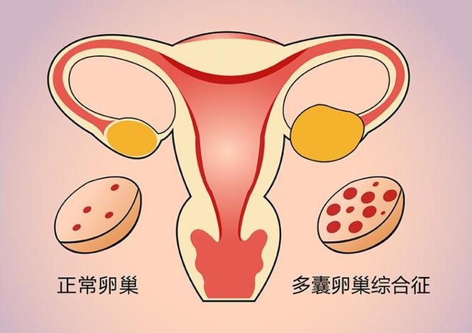 杭州三代试管囊胚筛查是什么，跟一代二代试管有啥区别