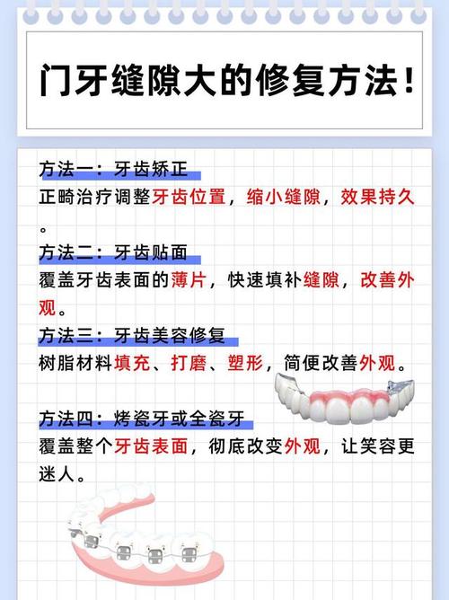 矫正牙齿门牙缝隙咋变大了_缝隙牙齿矫正门牙变大正常吗_缝隙牙齿矫正门牙变大怎么回事