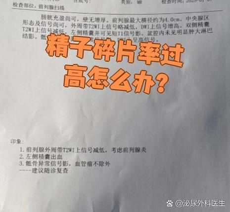 杭州精子DNA碎片率高怎么办 影响生育吗
