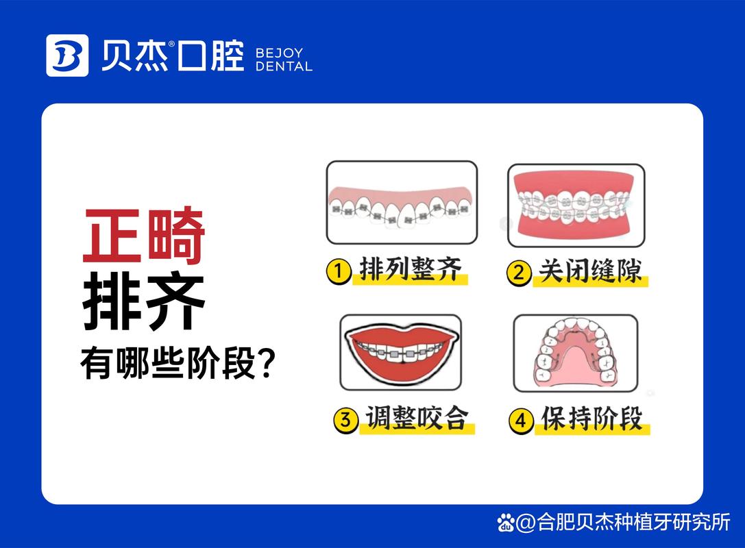 杭州儿童牙齿排列不齐去哪家医院矫正效果最好？