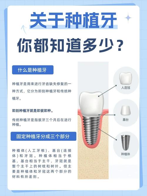 60岁以上能种植牙吗_牙可以种植_牙能种植以上的牙齿吗