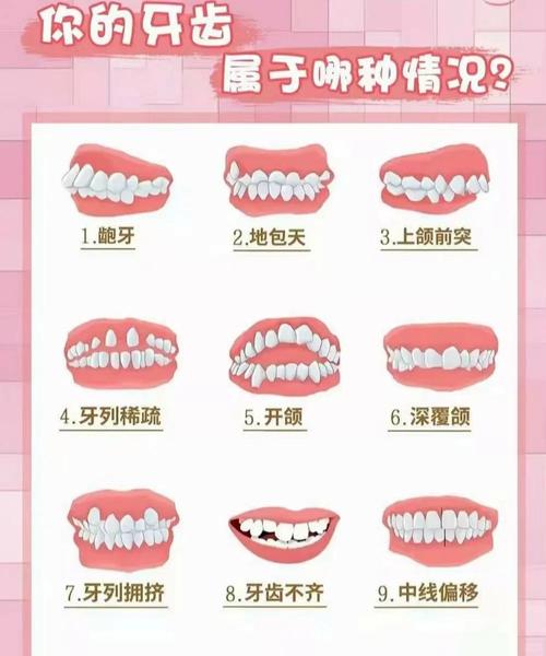 牙齿矫正可以只矫正几颗吗_牙齿矫正可以只做上排牙吗_18岁还可以矫正牙齿