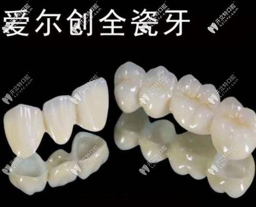 杭州深圳全瓷牙怎么选？这三家口碑好的牙科别错过