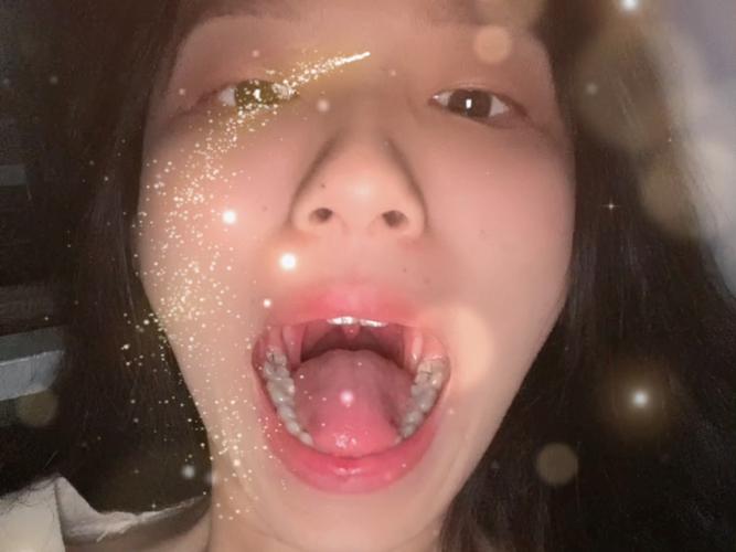 杭州口腔检查第一视角真的有用吗？