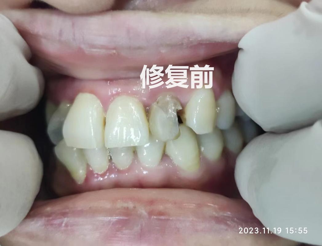 杭州口腔诊疗服务怎么挑不踩坑？看牙前你最好先把这几条搞明白