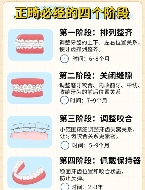 杭州26岁牙齿矫正要几年？过来人告诉你1.5-3年就够了