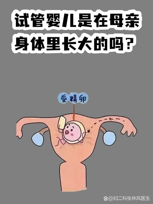 杭州试管婴儿常见误区有哪些 专家一次说清