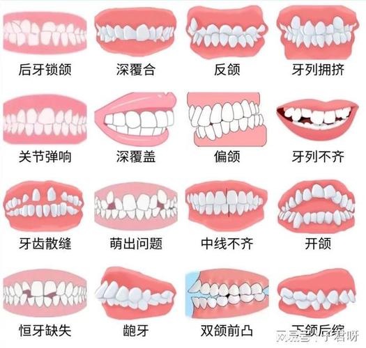 杭州儿童牙齿矫正一般价格多少？带娃整牙到底花几万