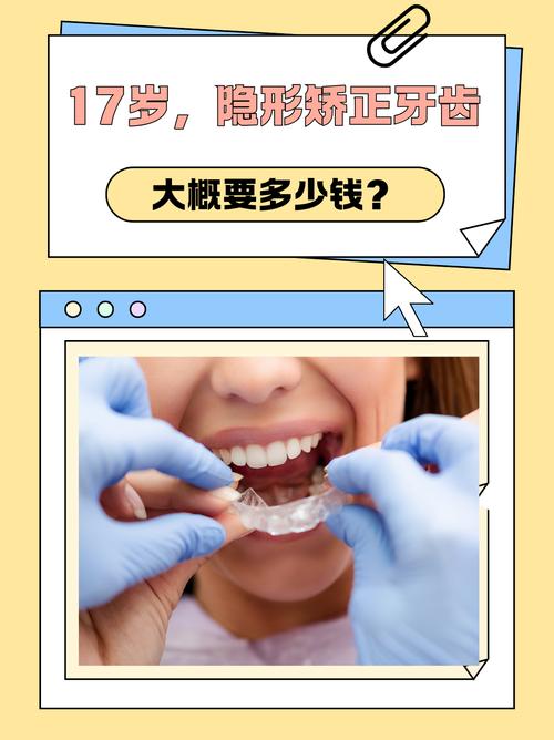杭州德韩隐形矫正牙齿效果好吗 价格多少
