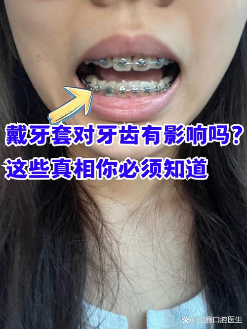 杭州成人矫正牙齿口腔值得做吗 这些真相医生不会主动说
