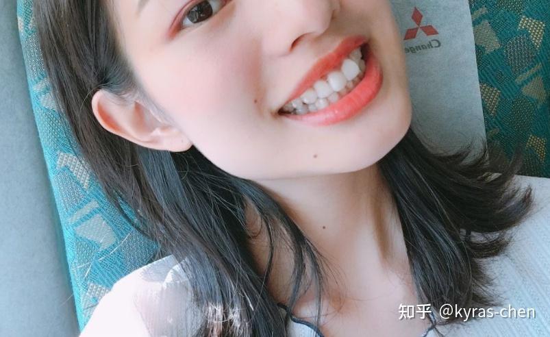杭州成人门牙不齐矫正真的很简单吗