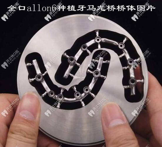 杭州深圳半口All-on-4种植牙医院怎么选？地址与避坑指南